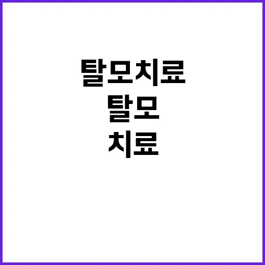 탈모치료, 이제 시작해볼까요? - 요약