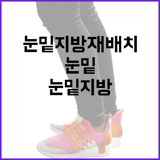 눈밑지방재배치, 이렇게 준비하세요 - 요약