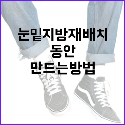 눈밑지방재배치로 동안 얼굴 만드는 방법 - 요약