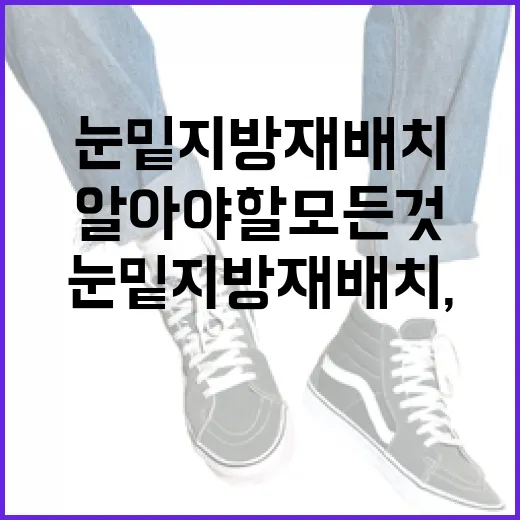 눈밑지방재배치, 당신이 알아야 할 모든 것 - 요약