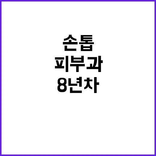 피부과전문의에게 보낸 손톱 사진, 네일리스트 8년 차가 뜨끔했던 이야기 - 요약