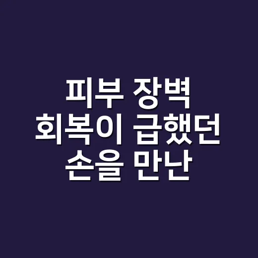 피부 장벽 회복이 급했던 손을 만난 날 - 요약