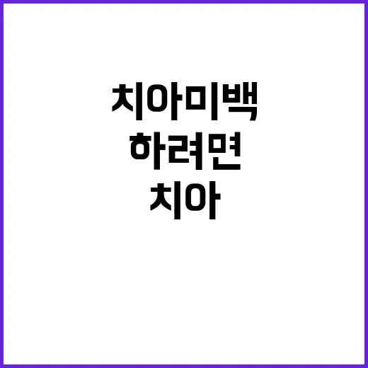치아미백 처음 하려면 이렇게 준비하세요 - 요약