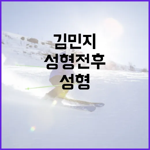 김민지의 성형 전후 모습 이해하기 - 요약