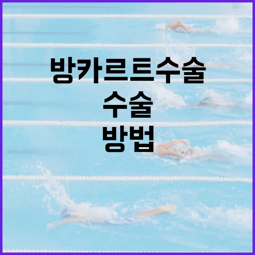 방카르트 수술을 이해하고 준비하는 방법 - 요약