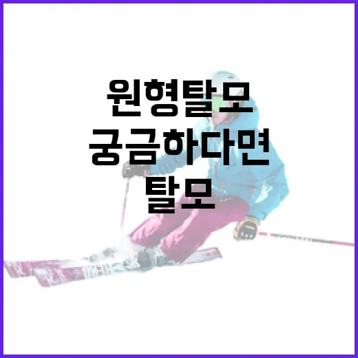 손흥민의 원형 탈모…