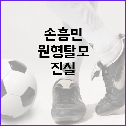 손흥민의 원형 탈모, 그 진실은? - 요약