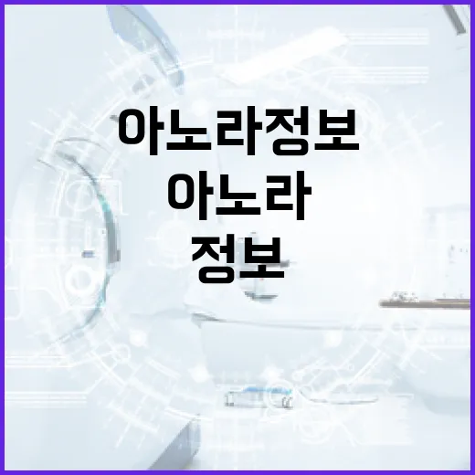 아노라 정보를 쉽게 이해하는 방법 - 요약