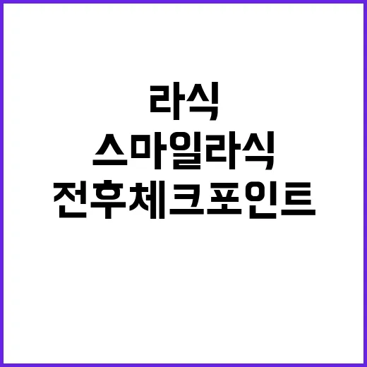 스마일라식 하려면 이렇게 확인하세요: 검사 전후 체크포인트 - 요약
