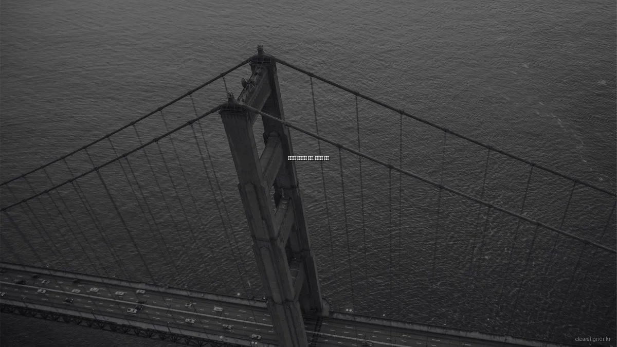 예산별 투명교정 추천: 가성비 분석