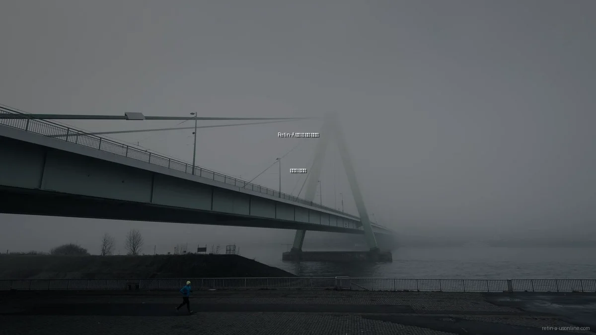 Retin-A 사용 시 흔한 실수와 예방법 총정리