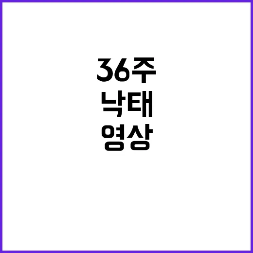 충격! 36주 태아 낙태 영상 유튜버와 병원장 연루