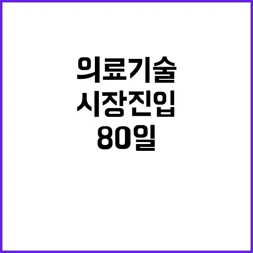 혁신 의료기술 80일 내 시장 진입 가능!