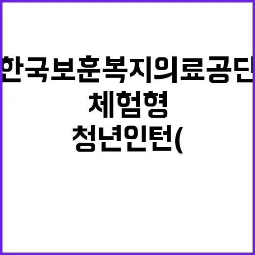 [중앙보훈병원] 청년인턴(장애예술인, 보조업무) 채용 공고