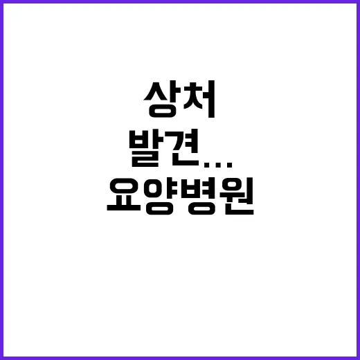 상처 발견…폭행 사…