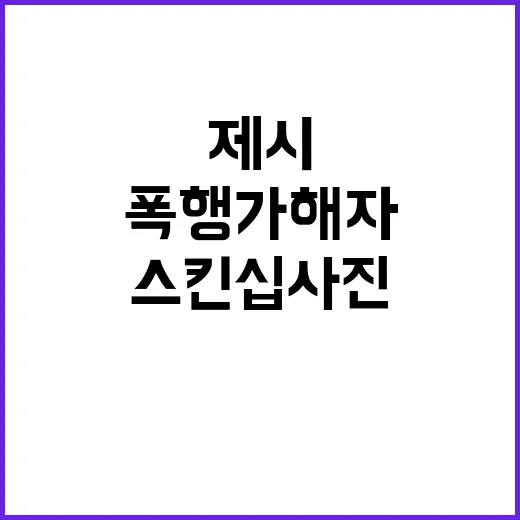 ‘스킨십 사진’ 공개 제시 폭행 가해자 드러나다!