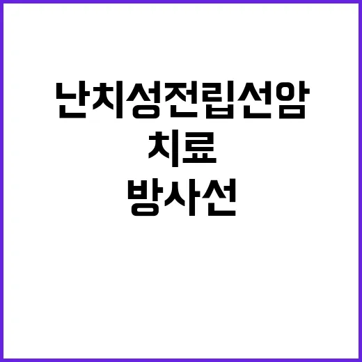 ‘방사선 미사일 치…