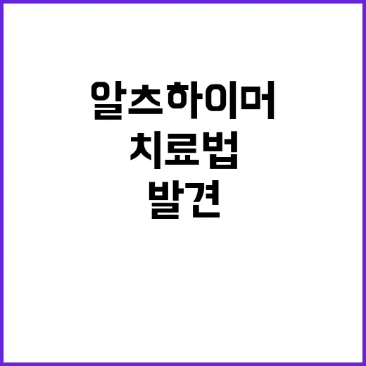 알츠하이머병 치료법…