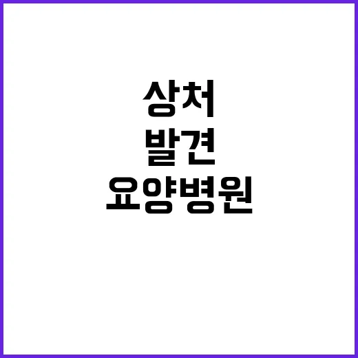 장례식 상처 발견 …