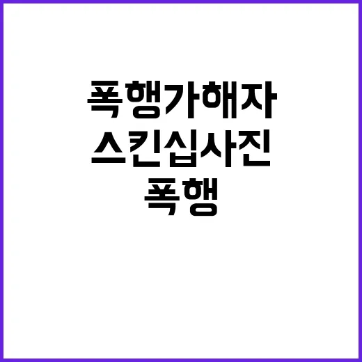 스킨십 사진 공개 …