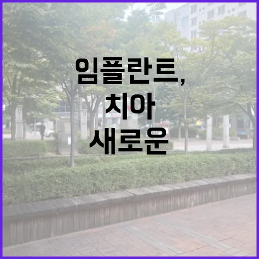 임플란트, 내 치아에 대한 새로운 투자!