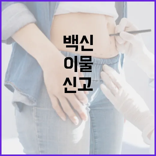 이물 신고 백신 제조번호 공개 논란 해명