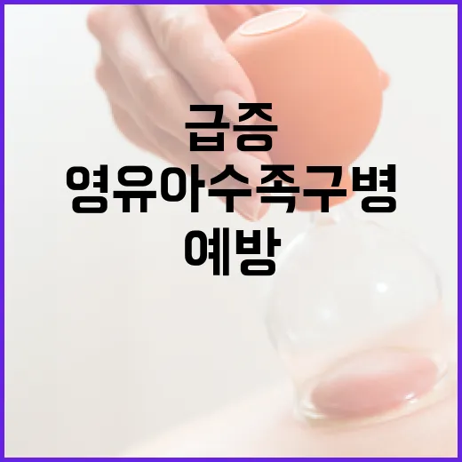 영유아 수족구병 급증, 예방이 최우선